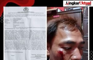 Waduh…!!! Lagi- Lagi Jurnalis Jadi Korban Kekerasan, DPW IWO-I Sumsel Kecam Keras Tangkap RL
