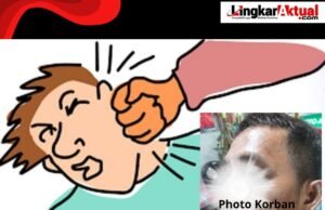 Pedagang Nasi di Sukatani Jadi Korban Dugaan Aksi Kekerasan Saat Penagihan oleh Seorang Bernama Hanapi (Black) Wajah Korban Alami Luka