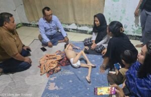 Miris! Muhammad Rizki Firdaus (13) Alami Gizi Buruk, Penanganan Dugaan Stunting Disorot