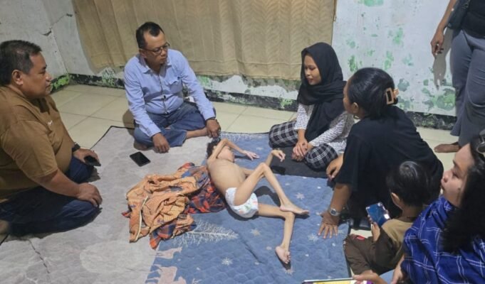 Miris! Muhammad Rizki Firdaus (13) Alami Gizi Buruk, Penanganan Dugaan Stunting Disorot